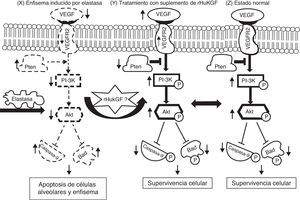 Hipótesis sobre el mecanismo de la inducción por el rHuKGF de la señalización de supervivencia mediada por Akt en el enfisema. El enfisema inducido por elastasa reduce los niveles de VEGF y de VEGFR2, con lo que modifica la señalización de supervivencia a través de PI-3K/Akt. Los factores de crecimiento (como VEGF, KGF etc.) y los factores de supervivencia activan receptores que reclutan PI3K hacia la membrana, lo cual activa a su vez la cinasa Akt. El antagonista Pten inhibe la supervivencia celular mediante una regulación negativa (que se indican con una flecha hacia abajo) de la vía de Akt a través de la desfosforilización. El Akt fosforila y compromete la función de las proteínas caspasa-9 y Bad, que intervienen en las vías de la muerte celular. Esta hipótesis corresponde a la desregulación de la supervivencia celular mediada por Akt en el grupo de enfisema inducido por elastasa (X). Se sabe que diversas moléculas, entre las que se encuentran varios factores de crecimiento, desempeñan un papel clave en la reparación y desarrollo del pulmón y en la supervivencia celular. En este caso, se cree que el suplemento de rHuKGF (S) induce la vía de supervivencia celular mediada por Akt en el enfisema y debe ser idéntico al grupo sano (Z). Akt: cepa de ratón Ak; Bad: promotor de muerte asociado a Bcl-2; PI3K: fosfatidilinosítido-3′-OH cinasa; Pten: homólogo de fosfatasa y tensina en cromosoma 10; t: timoma; VEGF: factor de crecimiento endotelial vascular; VEGFR2: receptor de VEGF.