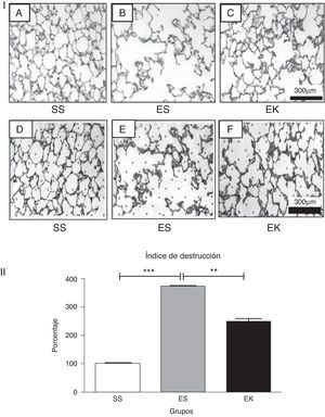 (3-I). Histopatología del área de intercambio de gases. Cortes de tejido con tinción de hematoxilina y eosina que muestran (A) una histología normal en los pulmones de control, (B) una rarefacción de los tabiques alveolares con espacios aéreos agrandados en los pulmones con enfisema y (C) un aumento de los espacios aéreos con engrosamiento de los tabiques alveolares en los pulmones tratados. Todas las microfotografías se tomaron con unos aumentos idénticos. Para la determinación del índice de destrucción, se coloca una lámina transparente con 80 puntos distribuidos por igual sobre la imagen digitalizada impresa de un corte con tinción de HE (D, E, F). Para cada punto, se determina el área circundante según los criterios mencionados en el apartado de Métodos. EK: elastasa-rHuKGF (grupo de tratamiento); ES: elastasa-solución salina (grupo de enfisema); rHuKGF: factor de crecimiento queratinocítico humano recombinante; SS: solución salina (grupo sano). (3-II). Análisis estadístico del índice de destrucción. A diferencia de lo observado en los pulmones sanos (SS), hubo un aumento significativo del índice de destrucción porcentual en el caso de los pulmones enfisematosos (ES), mientras que este se redujo con el suplemento de rHuKGF en los pulmones enfisematosos (EK). Los gráficos indican los valores de media con desviación estándar. Los datos se analizaron mediante la prueba de t para datos no emparejados, con objeto de evaluar el efecto del rHuKGF y la elastasa, respectivamente (fig. 3-II). EK: elastasa-rHuKGF (grupo de tratamiento); ES: elastasa-solución salina (grupo de enfisema); rHuKGF: factor de crecimiento queratinocítico humano recombinante; SS: solución salina (grupo sano). ***p ≤ 0,001 y **p ≤ 0,01 frente al correspondiente grupo de control.