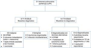 Diagrama de flujo de los procedimientos diagnósticos realizados y los diagnósticos finales de las LPP (PPL). NSCLC: non small cell lung carcinoma; CPNM: carcinomas pulmonares no microciticos; F-R-EBUS: fluoroscopic-guided radial probe endoBronchial ultraSound; F-R-EBUS: ecografia endobronquial con sonda radial guida por fluoroscopia; MALT: mucosa-associated lymphoid tissue; MALT: tejodo linfoide asociado a las mucosas.