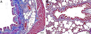 A, B: Arquitectura del tejido pulmonar normal de las ratas de control mediante microscopia óptica, tinción tricrómica de Masson.