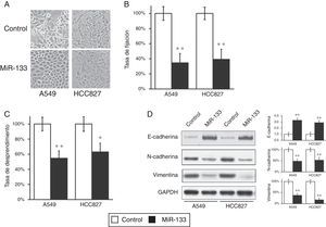 La expresión del MiR-133 inhibe la transición epitelio-mesenquimatosa (TEM) de células de cáncer de pulmón. A) Morfología celular observada en líneas celulares A549 y HCC827, tras transfección con control miARN negativo o miR-133. B,C) Las pruebas de fijación (B) y despegue celular (C) se efectuaron en líneas celulares A549 y HCC827, tras transfección con control miARN negativo o miR-133. D) La expresión de los marcadores proteicos fenotípicos de la TEM se analizó en líneas celulares A549 y HCC827, tras transfección con control miARN negativo o miR-133. La cuantificación de las expresiones de proteínas normalizadas a GAPDH también se muestra en los paneles de la derecha. Los valores son medias ± EEM de 3 experimentos independientes. * p < 0,05. ** p < 0,01 frente al control respectivo.