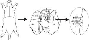 Extracción y preparación del pulmón donante. Realización de una estereotomía media y disección y extracción del bloque cardiopulmonar. Disección de la arteria pulmonar izquierda (LPA), vena pulmonares izquierdas (LPV) y del bronquio izquierdo (LBr).AO: aorta torácica; IVC: vena cava inferior; LA: aurícula derecha; L SVC: vena cava superior izquierda; LL: pulmón izquierdo; RA: aurícula izquierda; RL: pulmón derecho; R SVC: vena cava superior derecha.