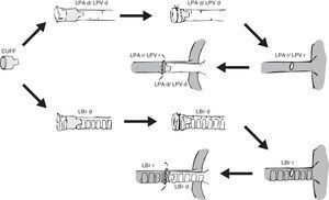 Esquema de colocación de un manguito o cuff en el pulmón donante y su anastomosis en el pulmón receptor.LBr d: bronquio izquierdo de animal donante; LBr r: bronquio izquierdo de animal receptor; LPA d: arteria pulmonar izquierda de animal donante; LPA r: arteria pulmonar izquierda de animal receptor; LPV d: vena pulmonar izquierda de animal donante; LPV r: vena pulmonar izquierda de animal receptor.