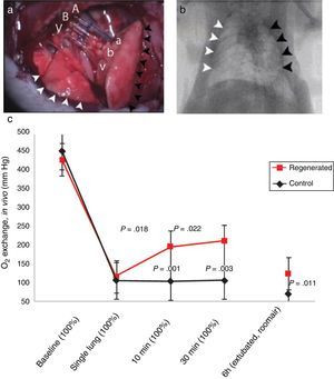 Orthotopic transplantation of a bioengineered rodent lung. (a) Photograph showing the implanted regenerated left lung. Recipient left pulmonary artery (A), left main bronchus (B) and left pulmonary vein (V) are connected to regenerated left lung pulmonary artery (a), bronchus (b) and pulmonary vein (v). White arrowheads, the recipient