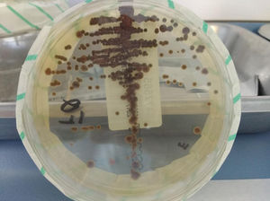 Colonias de Exophiala dermatitidis en placa de agar Sabouraud con cloranfenicol.