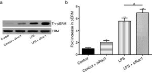 Rac1 inhibition and LPS stimulation (10mg/L) together increase threonine phosphorylation of ERM in PMVECs. (a) Western Blotting was used to assay the expressions of Thr-pERM and normal ERM in different groups and relative expressions from the Western Blotting (b). Data were presented as the mean±SD. N=6, *P<0.05, **P<0.01 compared to control group. #P<0.05 between LPS group and LPS+siRac1 group.