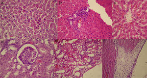 (a) Pyknotic nuclei in hepatocytes in doxycycline group (HE ×400); (b) periportal inflammation of liver tissue in sericin group (HE ×400); (c) sinusoidal dilatation of liver tissue in sericin group (HE ×400); (d) glomerular degeneration of kidney tissue in silver nitrate group (HE ×400); (e) tubular degeneration of kidney tissue in talcum powder group (HE ×400); (f) pericarditis in the pericardium in doxycycline group (HE ×400).