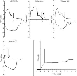 Several examples of efforts deemed as acceptable by spirometer softwares.