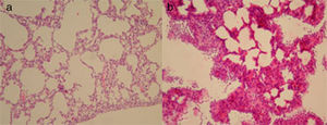 (a) Emphysema of parenchyma in Group-C (HE×200); (b) multi-layer mesothelial reaction of visceral pleura in Group-B (HE×200).