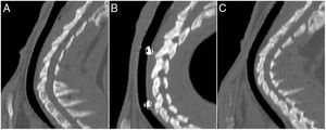 Imágenes de TC, reconstrucciones sagitales. A)Control. B)D30 (stent sin degradar). C)D90 (stent degradado).