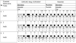 Ejemplo de intensidades de los autoanticuerpos contra antígenos extraíbles del núcleo en el lavado broncoalveolar en el inmunoblot.