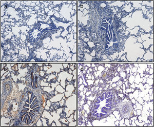 Apoptotic cell death is assessed by immunohistochemistry quantification of caspase-3. Caspase-3 positive cells are stained in brown. Representative images (a)–(d). According to the semiquantitative analysis, the percentage of stained cells in lung tissue as follows: (a) 5% corresponding to timepoint CIT0; (b) 5% corresponding to timepoint CIT1; (c) 20% corresponding to timepoint Rp30min; and (d) 15% corresponding to timepoint Rp4h.