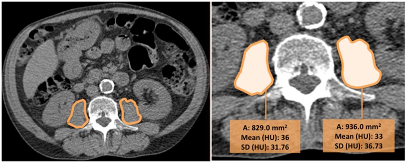 fig0020