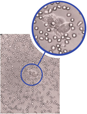 Lophomonas blattarum vista microscópica.