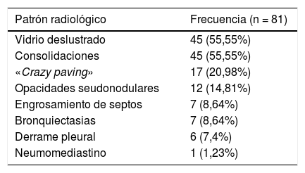 Tables