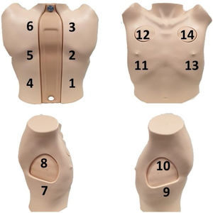 Protocolo de exploración11. 1. Basal derecho, en la línea paravertebral, sobre el signo de la cortina. 2. Medio derecho, en la línea paravertebral, en el ángulo inferior de la escápula. 3. Superior derecho, en la línea paravertebral, en la zona superior de la escápula. 4. Basal izquierdo, en la línea paravertebral, sobre el signo de la cortina. 5. Medio izquierdo, en la línea paravertebral en el ángulo inferior de la escápula. 6. Superior izquierdo, en la línea paravertebral, en la zona superior de la escápula. 7. Basal derecho, en la línea axilar media, debajo de la línea de la aréola mamaria. 8. Superior derecho, en la línea axilar media por encima de la aréola mamaria. 9. Basal izquierdo en la línea axilar media debajo de la aréola mamaria.10. Parte superior izquierda en la línea axilar media encima de la aréola mamaria. 11. Basal derecho en la línea clavicular media debajo de la aréola mamaria. 12. Parte superior derecha, en la línea clavicular media, encima de la aréola mamaria. 13. Basal izquierdo, en la línea clavicular media, debajo de la aréola mamaria. 14. Parte superior izquierda, en la línea clavicular media, encima de la aréola mamaria. Imagen de elaboración propia.