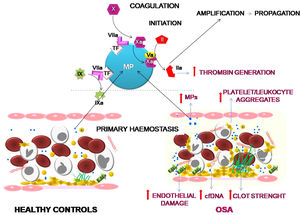 Effects of OSA on primary hemostasis and coagulation. OSA induces the formation of a stronger clot and increased formation of platelet-leukocyte aggregates. Moreover, OSA provokes an endothelial damage that causes a higher release of cfDNA and of MPs containing TF that enhance capacity for the generation of thrombin.