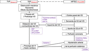 Biomarcadores en la fisiopatogenia de la tromboembolia pulmonar aguda. Los biomarcadores son posicionados en el esquema de acuerdo con el mecanismo fisiopatológico que expresan y según la utilidad diagnóstica (en rojo) o pronóstica (en morado). AP: arteria pulmonar; BNP: péptido natriurético tipo B; H-FABP: proteína ligadora de ácidos grasos cardiacos; GDF-15: factor de diferenciación de crecimiento 15; HPTEC: hipertensión pulmonar tromboembólica crónica; LMR: relación linfocito-monocito; MR-proADM: región media de la proadrenomedulina; NGAL: lipocalina asociada con la gelatinasa de neutrófilos; NLR: relación neutrófilo-linfocito; NT-proBNP: fragmento amino-terminal del proBNP; O2: oxígeno; PLR: relación plaqueta-linfocito; pO2: presión arterial de oxígeno; TEP: tromboembolia pulmonar; TVP: trombosis venosa profunda; VD: ventrículo derecho; VI: ventrículo izquierdo.