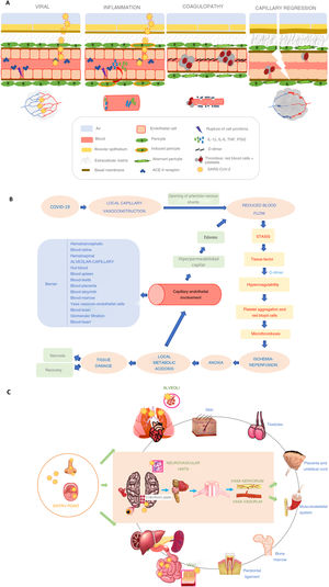 (A) Alveolocapillary barrier damage caused by SARS-CoV-2 infection. (B) Multisystemic physiopathology of COVID-19. (C) Central and peripheral mechanisms responsible for the dysregulation of vascular tone in SARS-CoV-2 infection.