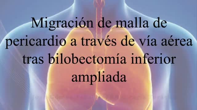 https://ars.els-cdn.com/content/image/1-s2.0-S030028962200309X-mmc1.mp4