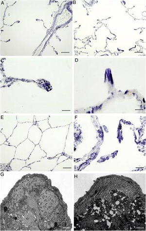 Localization of elastic fibres in lung samples from COPD patients and control subjects. Verhoeff