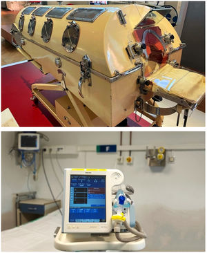 Comparison between the iron lung, the first non-invasive ventilator, and a state-of-the-art ventilator (Philips V60 Plus).
