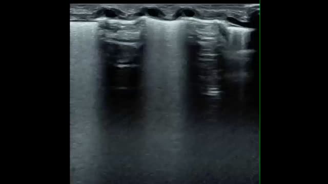 https://ars.els-cdn.com/content/image/1-s2.0-S0300289622005117-mmc1.mp4
