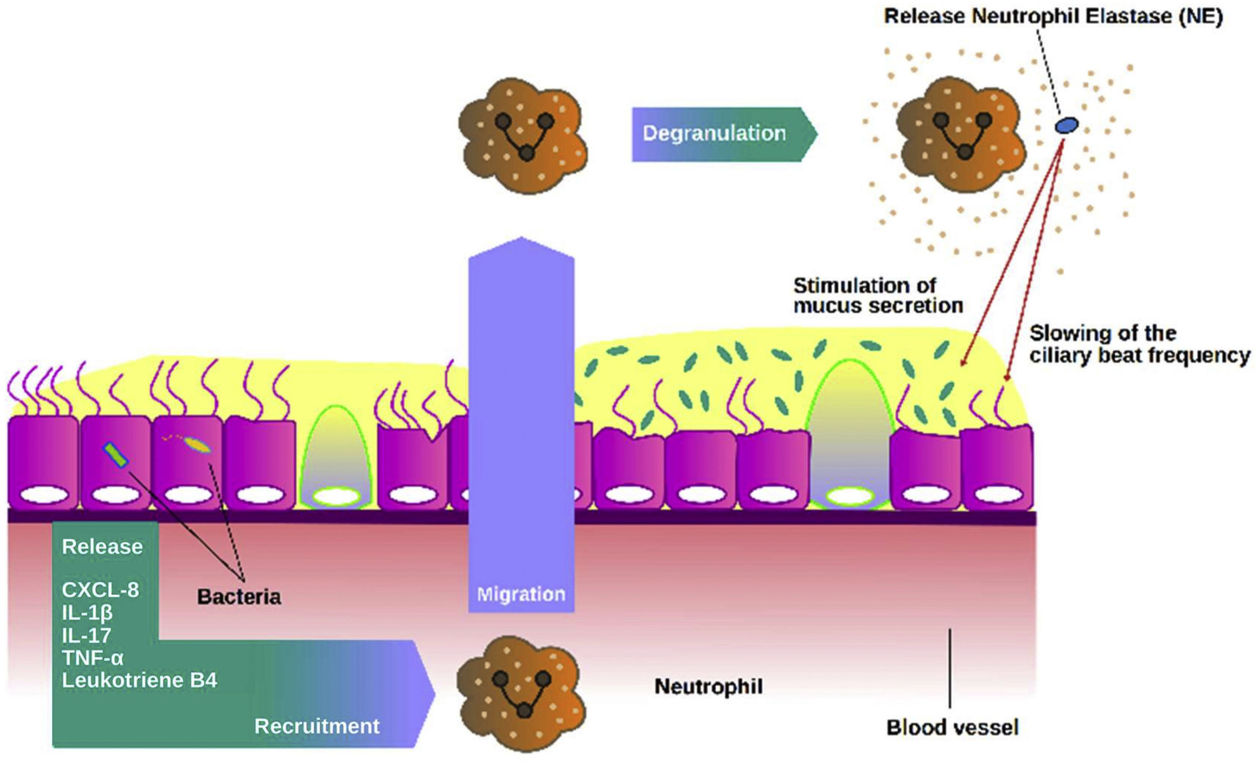 Pathophysiology of Chronic Bronchial Infection in Bronchiectasis ...
