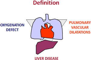 Sketch illustrating the three key criteria to establish the diagnosis of HPS: an arterial oxygenation defect (i.e., AaPO2≥15mmHg with or without a PaO2<80mmHg, while breathing ambient air); a chronic hepatic disorder; and the presence of intrapulmonary vascular dilatations (IPVD), as assessed by either positive findings on contrast-enhanced echocardiography with air bubbles or abnormal uptake in the brain [>6%] with radioactive lung-perfusion scanning.