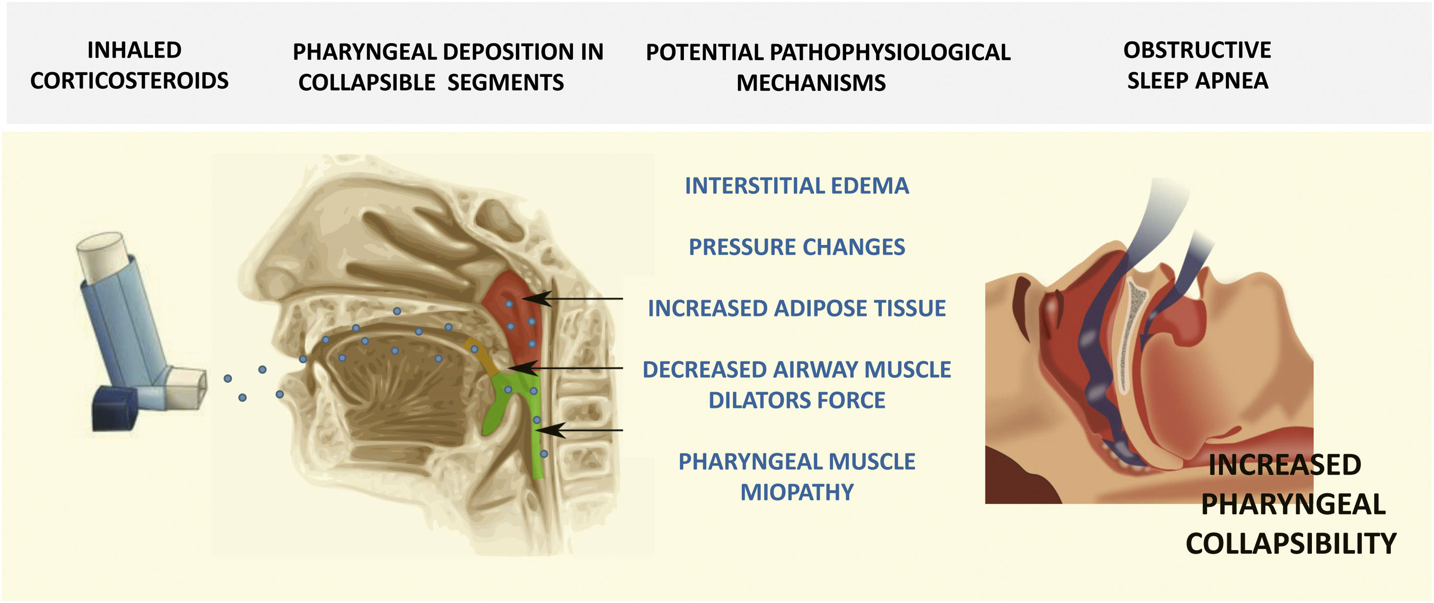 Do Inhaled Corticosteroids Increase the Risk of Obstructive Sleep Apnea ...