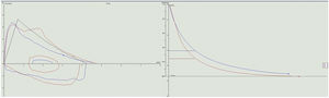 Flow-volume chart (left) and volume-time chart (right). Blue line: baseline spirometry; red line: post-bronchodilator.