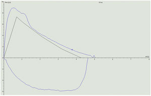 Flow-volume chart after discontinuing ponesimod.