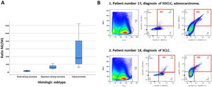 Characterization of alveolar macrophage populations. (A) M2/M1 ratio according to definitive diagnosis. (B) Different examples of flow cytometry of included patients. SCLC: small cell lung cancer, SSC: side scatter channel, FSC: forward scatter channel.