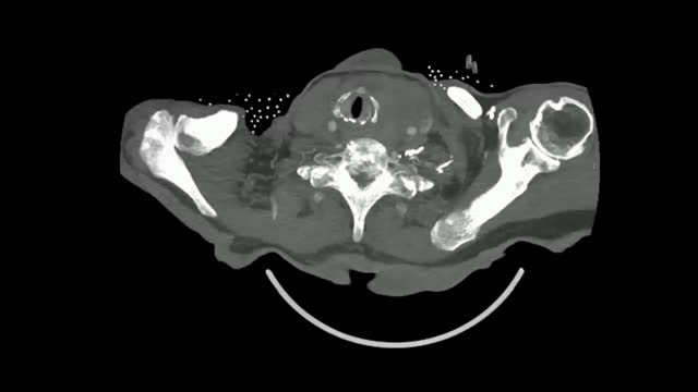 https://ars.els-cdn.com/content/image/1-s2.0-S0300289624000127-mmc1.mp4