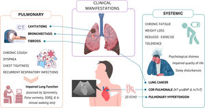 Clinical manifestations of PTLD: Visual summary of common pulmonary lesions and symptoms (left) versus extra-pulmonary manifestations (right) observed after TB treatment. CT=computed tomography; SGRQ=St. George