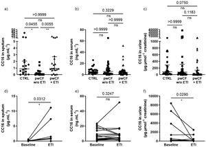 Restoration of CC16 concentration in sputum from people with cystic fibrosis (pwCF) with elexacaftor/tezacaftor/ivacaftor (+ETI) compared with pwCF without ETI treatment (w/o ETI) and non-CF healthy controls (CTRL), increase in CC16 sputum level and decrease in CC16 urine level after ETI initiation. (a) CC16 concentration in sputum from 17 non-CF healthy controls (CTRL), 15 pwCF w/o ETI and 20 pwCF with ETI (Kruskal–Wallis test and Dunn