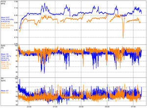Transcutaneous measured nocturnal gas-exchange with SenTec before and after 12 weeks of IMT. Blue colour lines indicate measurement before IMT, orange colour lines after IMT. The top row visualizes PtcCO2 (kPa), the middle row the saturation (%) and the bottom row the pulse rate (PR) in bpm.