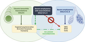 Potential future of interventional pulmonology in COPD: Sequential and multimodal bronchoscopic treatments: Highly selected patients with severe emphysema can benefit from BLVR with EBVs (blue arrow). On the other side, emerging bronchoscopic treatment options (targeted lung denervation, bronchial rheoplasty, metered cryospray) may cover patients with chronic bronchitis and/or exacerbations, with or without emphysema (green arrow). But for patients with both severe emphysema and hyperinflation and exacerbations, BLVR are contraindicated. A sequential treatment starting with a treatment targeting the airways and in case of favorable outcomes, BLVR may be a new approach (light green arrow).