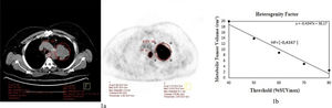1a. An example of measurement of primary tumor and lymph node metabolic parameters in 18F-FDG PET/CT imaging. Figure represents primary tumor and metastatic lymph node. Primary tumor SUVmax 15.63 and MTV 179.66 cm3; lymph node SUVmax 8.67 and MTV 6.94 cm3. 1b. An example of the heterogeneity factor calculations. The graph in the figure shows that HF is calculated by taking the derivative of the volume threshold function for each tumor. The absolute value of the calculated slope forms the HF value.