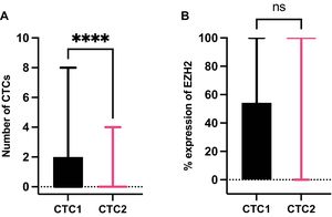 Dynamics of circulating tumor cells (CTCs) and expression of EZH2 in CTCs from NSCLC patients. (A) Differences in the number of CTCs between CTC1 (before surgery) and CTC2 (one month after surgery). ****: p value for Wilcoxon test, p=0.0001. (B) Comparison of the percentage of expression of EZH2 at CTC1 and CTC2. Abbreviation n.s. is not significant for Mann–Whitney U test, p=0.2562).