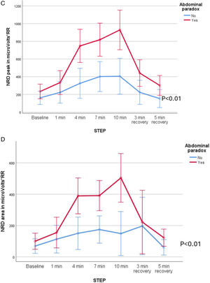 (A–D) Neurorespiratory drive (NRD peak and area in microv*RR) in patients with clockwise and counterclockwise rotation (A and B) and abdominal paradox (C and D) during exercise with NIV. Comparisons were made through ANOVA for repeated measures.