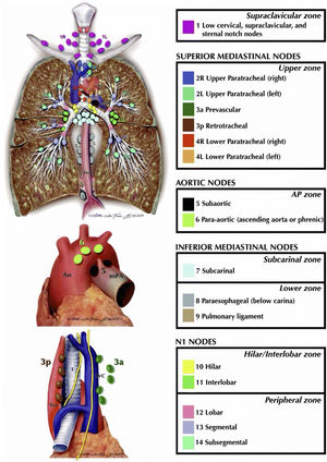 The International Association for the Study of Lung Cancer lymph node map.