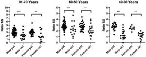 Leukocyte telomere shortening in patients versus controls of the same age and sex 1 year after SARS-CoV-2 infection. Mean comparisons were performed using the Student t test. Telomere shortening was observed in all age groups in patients after COVID-19 compared with matched controls. Pat indicates patients; ctrl, controls.