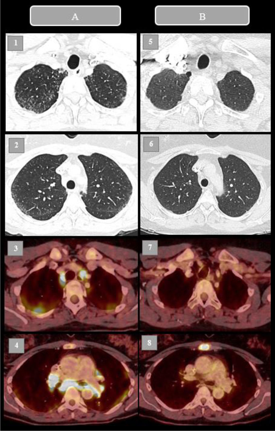 fig0005