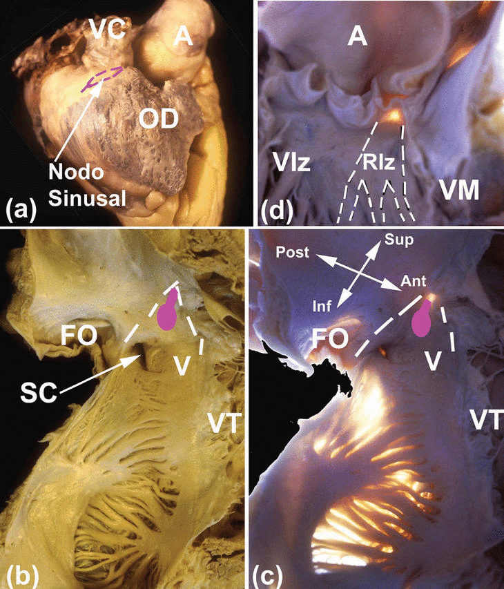 Anatomía Del Nodo Sa