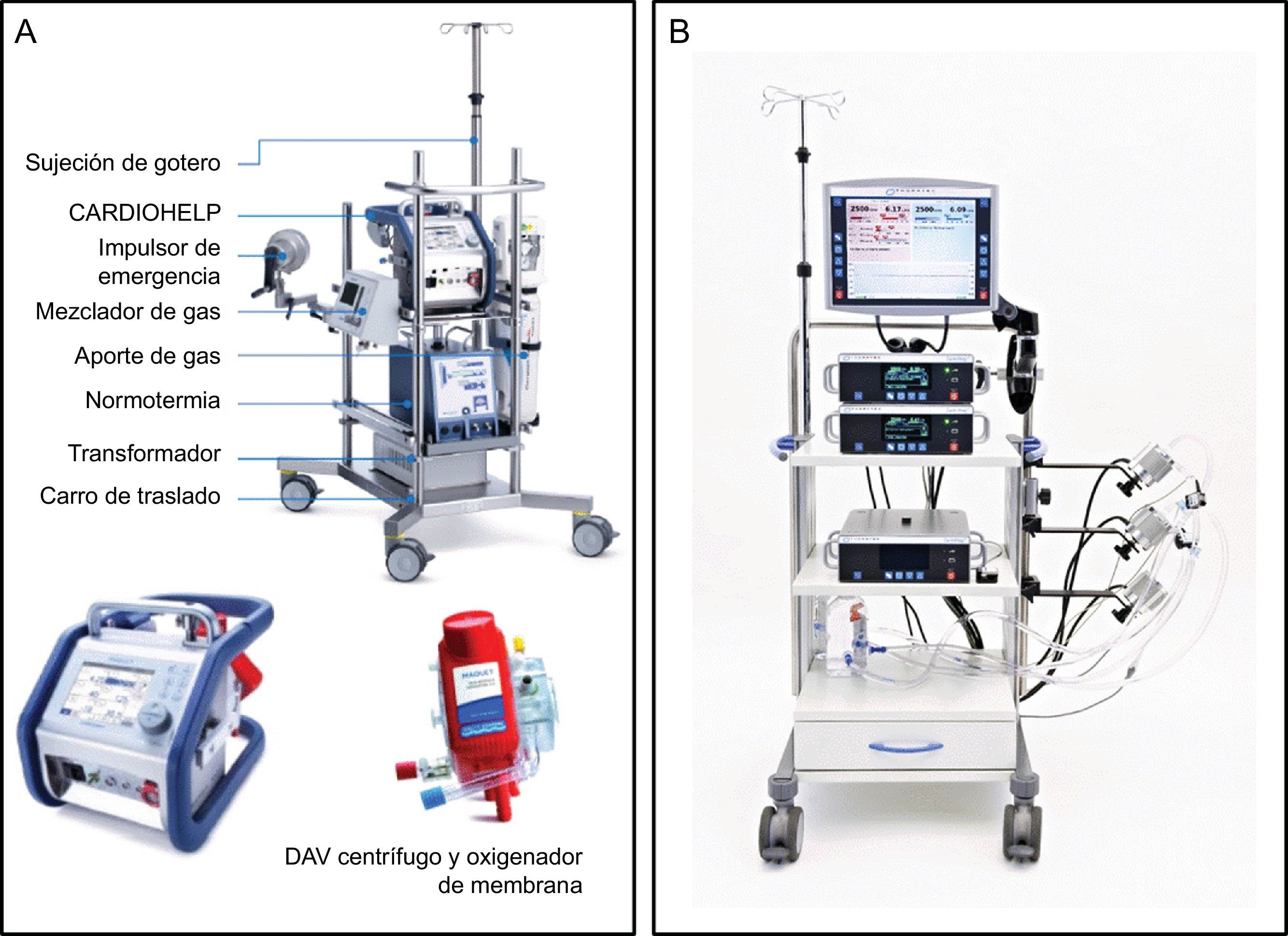 Trasplante cardiaco y soporte circulatorio mecánico para pacientes con ...