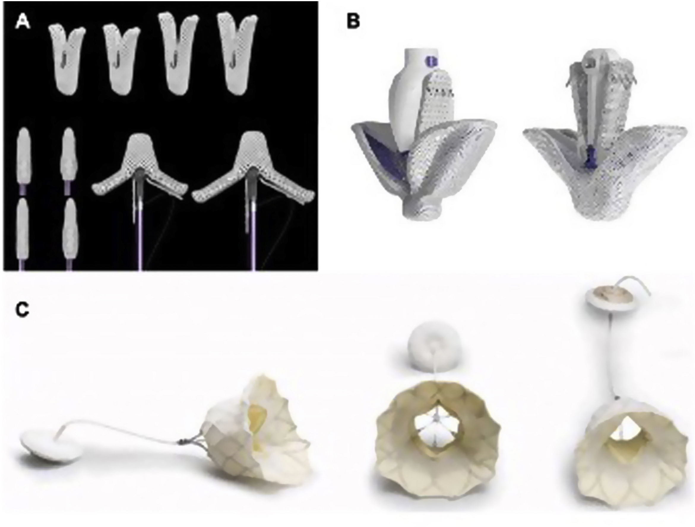 Valvulopatía mitral y tricuspídea: diagnóstico y tratamiento ...