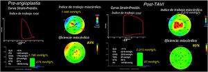 Imagen extra