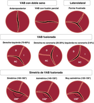 Figura 1