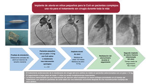 Graphical Abstract Implante de stent para la estenosis recurrente tra...